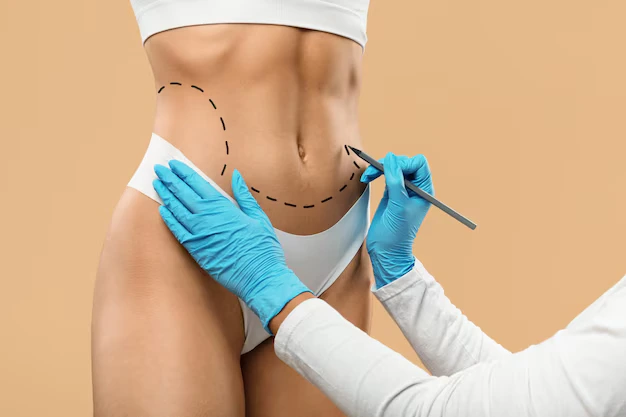Murat Diyarbakırlıoğlu | Liposucción Vaser – Eliminación de Grasa