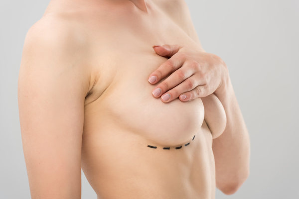 breast-reconstruction-surgery-procedure-techniques-and-recovery-timeline-10.jpg