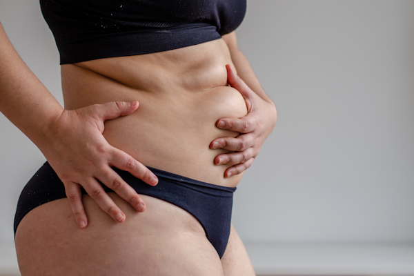 What Is a Mommy Makeover and What Procedures Can It Include?