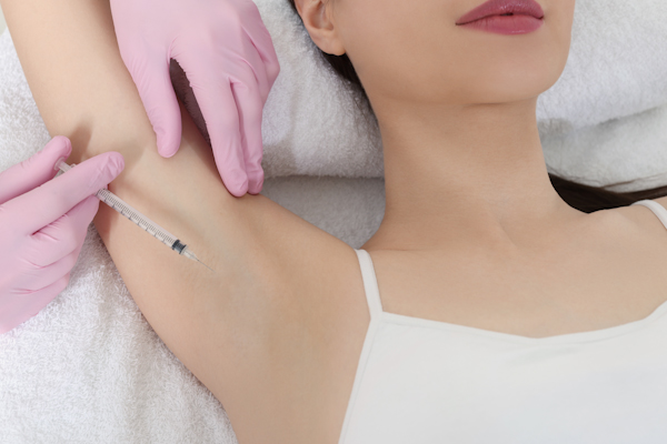 Botox-for-Excessive-Sweating-Treatment