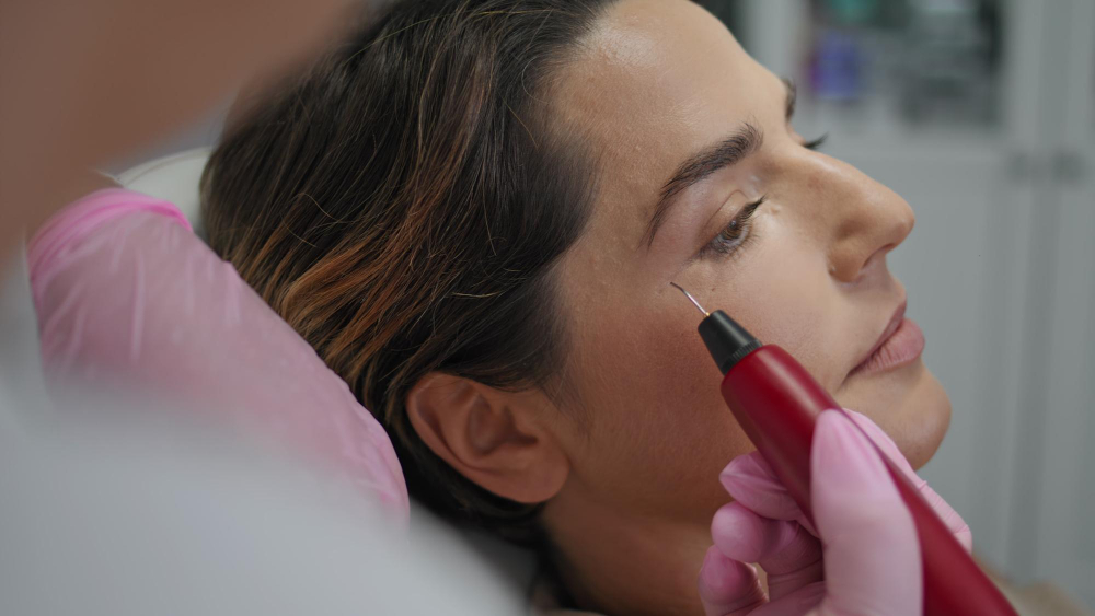 Dermapen, kontrollü mikro iğneleme yöntemiyle cildin doğal yenilenme sürecini desteklemeyi amaçlayan medikal estetik uygulamalardan biridir. Akne izleri, ince çizgiler, geniş gözenek görünümü, cilt tonu düzensizlikleri ve bazı yüzeysel cilt problemlerinde kişiye özel olarak planlanabilir.