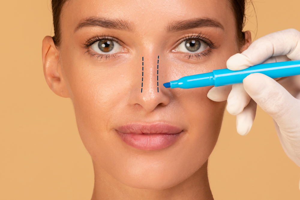 La rhinoplastie n’est pas une intervention standardisée destinée à créer le même nez chez tous les patients. L’anatomie nasale, l’épaisseur de la peau, la respiration, les proportions du visage et les attentes esthétiques sont évaluées ensemble.